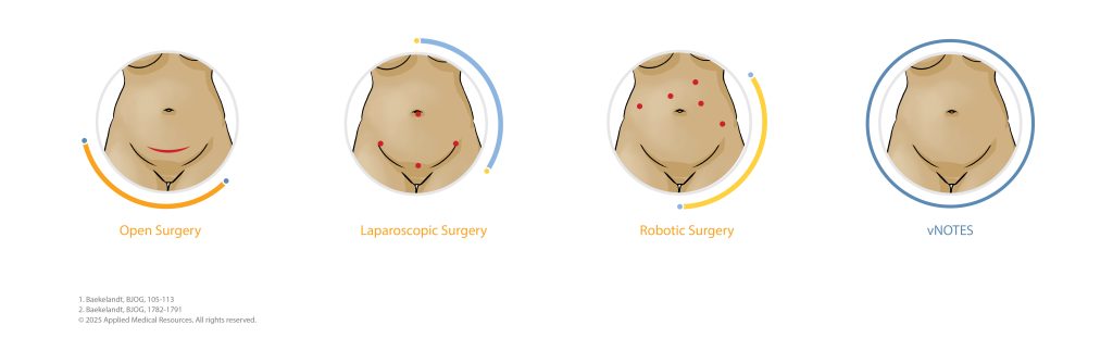 Scar comparison