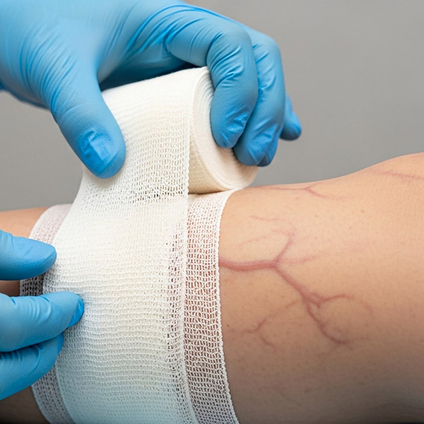 Vein care