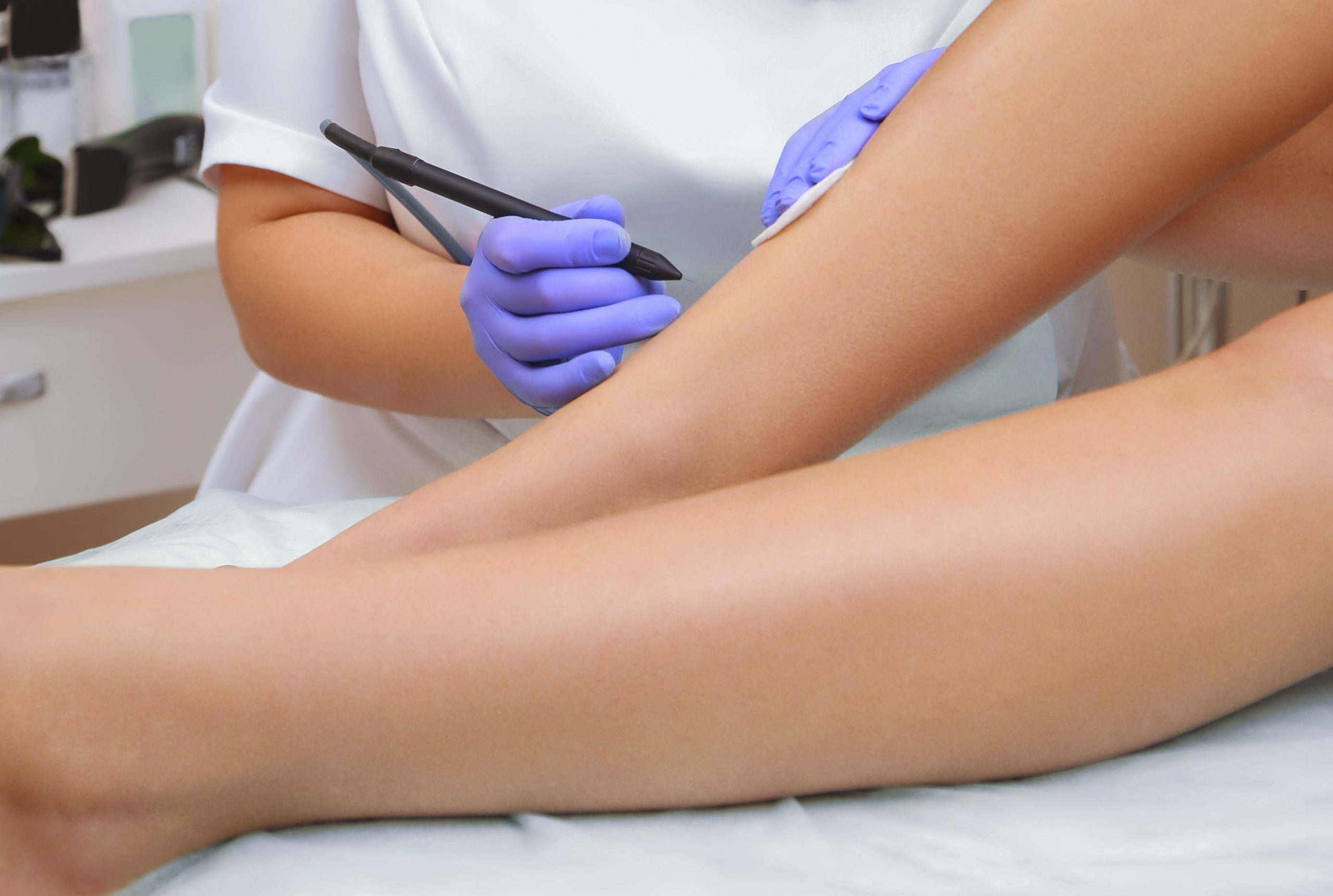 radiofrequency ablaison