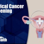 Cervical Cancer Screening Featured Image